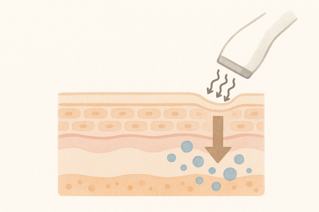 エレクトロポレーションで電気パルスにより美容成分が肌へ浸透していくイメージ図。柔らかなタッチで肌の断面と導入の流れを表現。