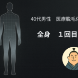 落ち着いた黒背景に、全身の人体を抽象的に描いたシルエットと淡いシルバーのハイライトが重なった画像。全身脱毛のテーマを控えめに示す、穏やかな印象のアイキャッチ。