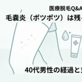 医療脱毛後に起こる毛嚢炎（ポツポツ）について解説する清潔感のあるアイキャッチイラスト