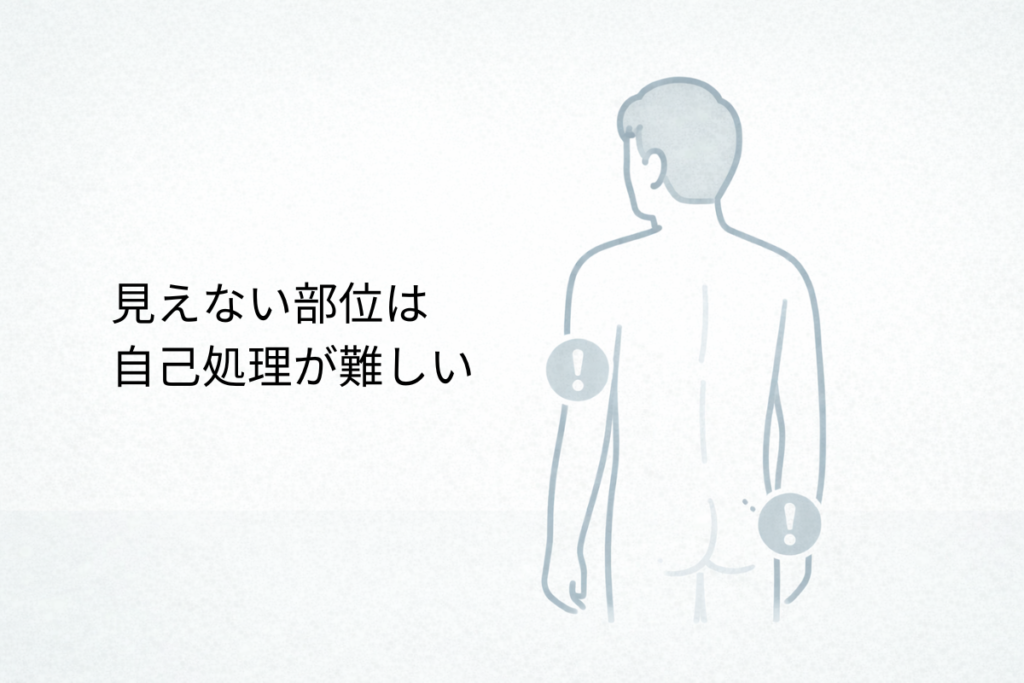 Oラインや脇など見えにくい部位は自己処理が難しいことを示す背面シルエットのイラスト
