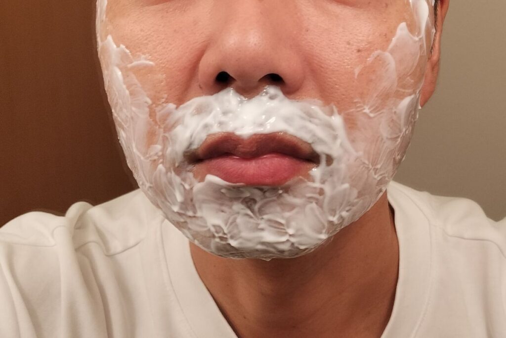 ヒゲ脱毛の施術1時間前に麻酔クリームを厚めに塗った状態の写真。初回の痛み対策として準備している様子。