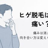 ヒゲ脱毛の痛みや麻酔の必要性を考える40代男性のイラスト