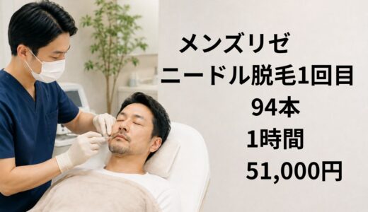 メンズリゼでニードル脱毛を受けた｜ヒゲ白髪94本・1時間・51,000円の体験記