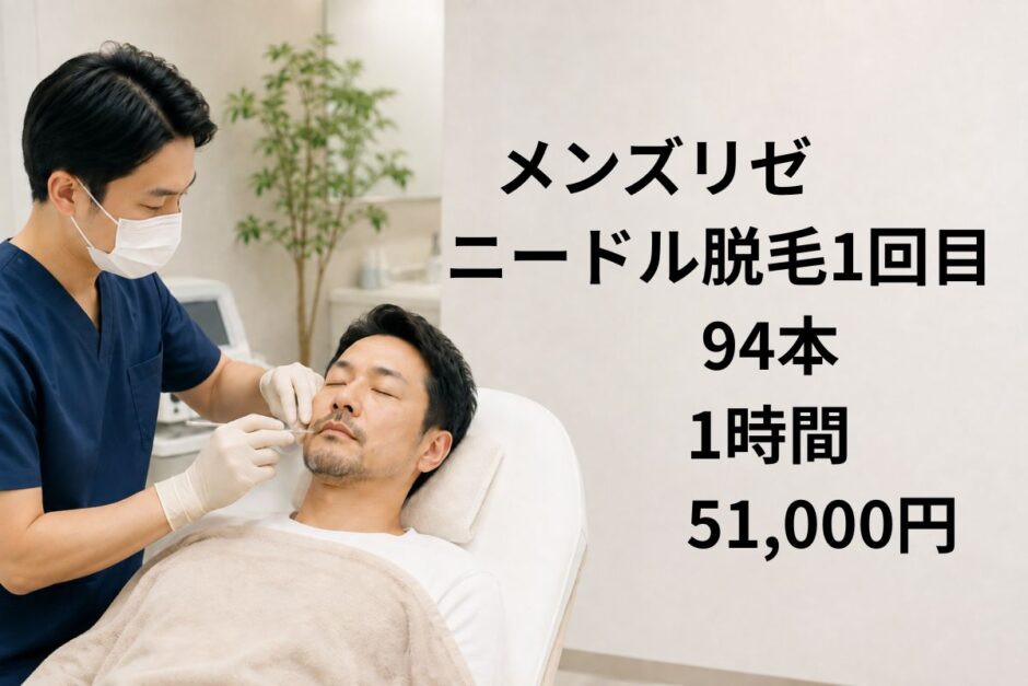 医療クリニックでヒゲのニードル脱毛を受ける40代男性のイメージ
