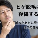 ヒゲ脱毛後に口周りとアゴの状態を確認しながら考える40代男性