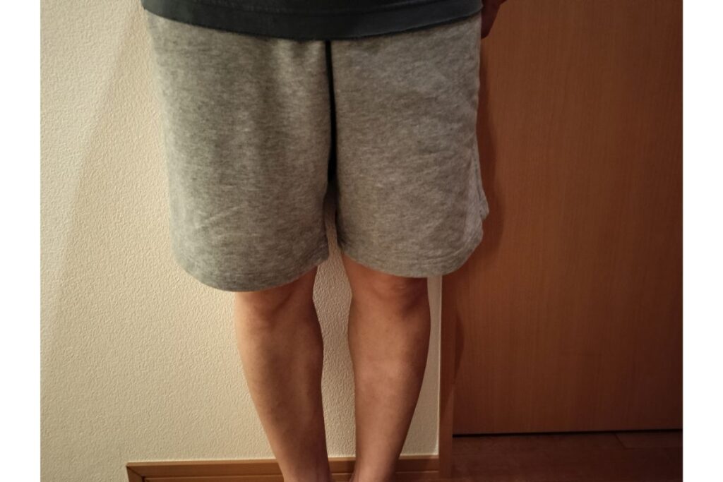 全身脱毛後に自宅で短パンを履いている40代男性
