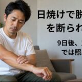 日焼けした前腕を見ながら医療脱毛できるか考える40代男性